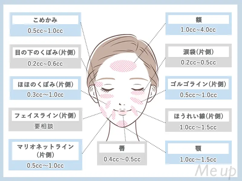 ヒアルロン酸注入量について顔の部位別の説明をしたイラスト
